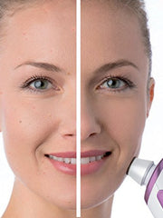 Load image into Gallery viewer, Beurer FC 76